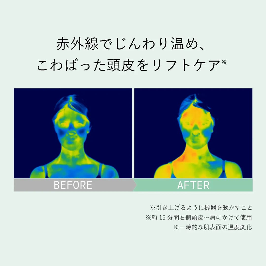 ビューティーヘッドスパ 10