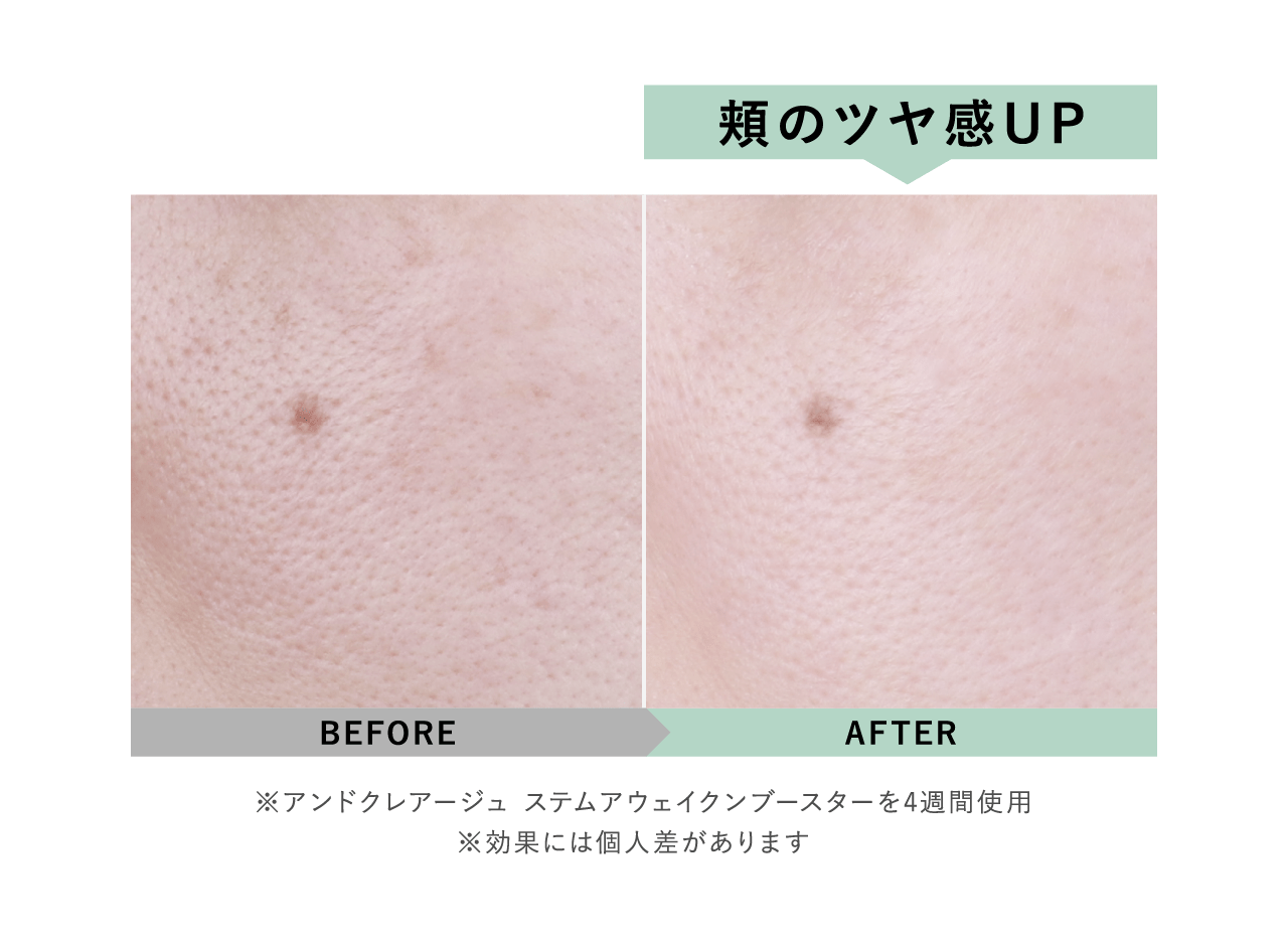 頬のツヤ感UP BEFORE AFTER ※アンドクレアージュ ステムアウェイクンブースターを4週間使用 ※効果には個人差があります